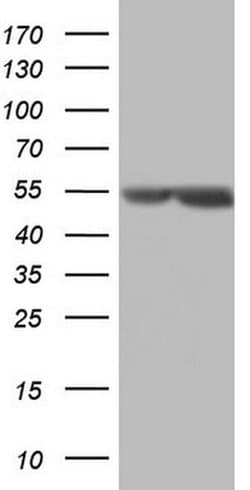 MSLN Monoclonal Antibody (OTI8H7), TrueMAB , OriGene 100 &mu;L; Unconjugated:Antibodies,