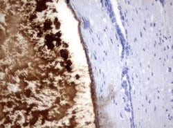 MSMB Monoclonal Antibody (OTI12F2), TrueMAB , OriGene 100 &mu;L; Unconjugated:Antibodies,