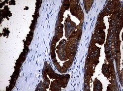 MSMB Monoclonal Antibody (OTI2C11), TrueMAB , OriGene 30 &mu;L; Unconjugated:Antibodies,