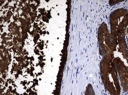 MSMB Monoclonal Antibody (OTI8F11), TrueMAB , OriGene 100 &mu;L; Unconjugated:Antibodies,