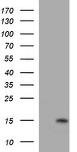 MSMB Monoclonal Antibody (OTI2C3), TrueMAB , OriGene 30 &mu;L | Buy Online | Origene Technologies | Fisher Scientific