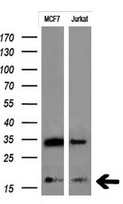 MSMB Mouse anti-Human, Clone: OTI2H1, lyophilized, TrueMAB 100 &mu;g; Unconjugated:Antibodies,