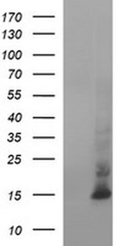 MSMB Monoclonal Antibody (OTI20F2), TrueMAB , OriGene 100 &mu;L | Buy Online | Origene Technologies | Fisher Scientific