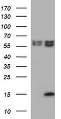 MSMB Monoclonal Antibody (OTI12F2), TrueMAB , OriGene 100 &mu;L; Unconjugated:Antibodies,