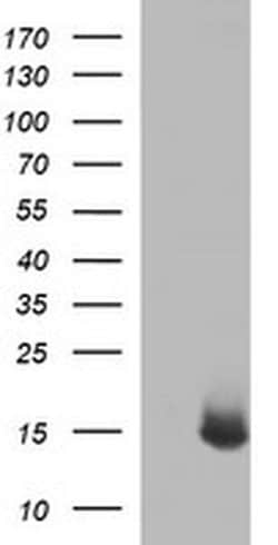 MSMB Monoclonal Antibody (OTI2H8), TrueMAB , OriGene:Antibodies:Primary