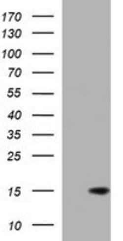 MSMB Mouse anti-Human, Clone: OTI5G4, lyophilized, TrueMAB 100 &mu;g; Unconjugated:Antibodies,