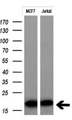 MSMB Monoclonal Antibody (OTI2C11), TrueMAB , OriGene 30 &mu;L; Unconjugated:Antibodies,