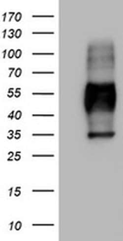 MSR1 Monoclonal Antibody (OTI2B5), TrueMAB , OriGene 30 &mu;L | Buy Online | Origene Technologies | Fisher Scientific