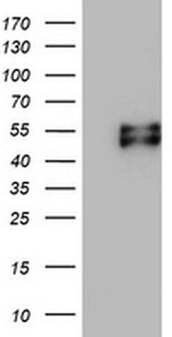 MSR1 Monoclonal Antibody (OTI1F10), TrueMAB , OriGene 30 &mu;L; Unconjugated:Anticuerpos
