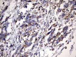 MSRB3 Monoclonal Antibody (OTI2A2), TrueMAB , OriGene 100 &mu;L; Unconjugated:Antibodies,