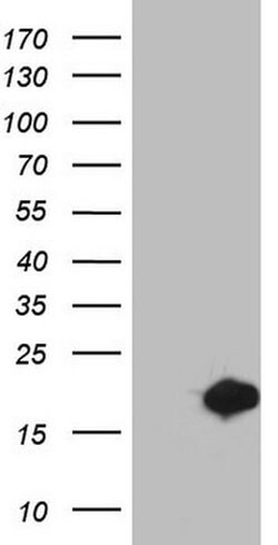 MSRB3 Monoclonal Antibody (OTI2A2), TrueMAB , OriGene 100 &mu;L; Unconjugated:Antibodies,