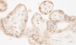 MST1-2/STK3-4 Rabbit anti-Human, Mouse, Polyclonal, Bethyl Laboratories