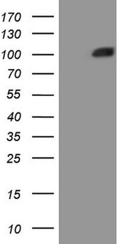 MST1 Mouse anti-Human, Clone: OTI1A10, lyophilized, TrueMAB 100 &mu;g;