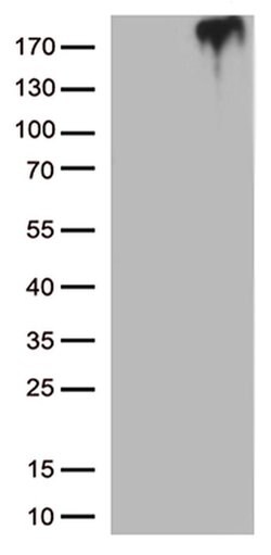 MST1R Monoclonal Antibody (OTI1D12), TrueMAB , OriGene 100 μL; Unconjugated:Antibodies,