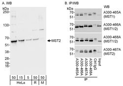 MST2/STK3 Rabbit anti-Human, Polyclonal, Bethyl Laboratories 100 &mu;l;