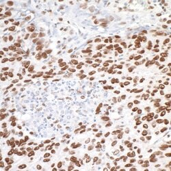 MTA1 Rabbit anti-Human, Mouse, Polyclonal, Bethyl Laboratories 100 &mu;L;