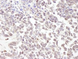 MTA1 Polyclonal Antibody, Bethyl Laboratories 100 &mu;L; Unconjugated:Antibodies,