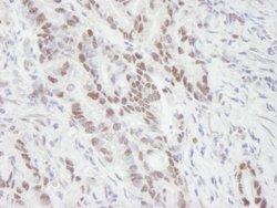 MTA1 Polyclonal Antibody, Bethyl Laboratories 100 &mu;L; Unconjugated:Antibodies,