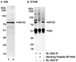 MTA2 Rabbit anti-Human, Polyclonal, Bethyl Laboratories 100 &mu;L; Unconjugated:Antibodies,
