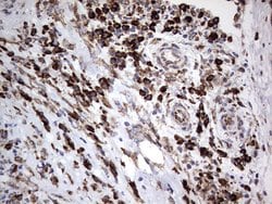 MTDH Monoclonal Antibody (OTI1E7), TrueMAB , OriGene:Antibodies:Primary