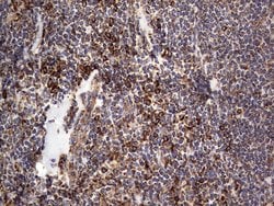 MTDH Monoclonal Antibody (OTI1E7), TrueMAB , OriGene 100 &mu;L; Unconjugated:Antibodies,