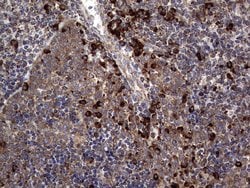 MTDH Monoclonal Antibody (OTI1E7), TrueMAB , OriGene:Antibodies:Primary