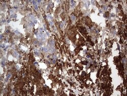 MTDH Mouse anti-Human, Clone: OTI2H4, lyophilized, TrueMAB 100 &mu;g; Unconjugated:Antibodies,