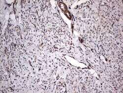 MTDH Mouse anti-Human, Clone: OTI2H4, lyophilized, TrueMAB 100 &mu;g; Unconjugated:Antibodies,