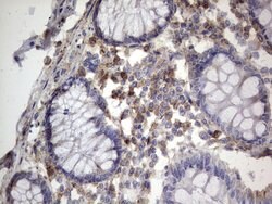 MTDH Mouse anti-Human, Clone: OTI2H4, lyophilized, TrueMAB 100 &mu;g; Unconjugated:Antibodies,