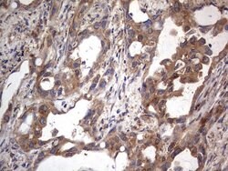MTDH Mouse anti-Human, Clone: OTI2F11, lyophilized, TrueMAB 100 &mu;g;