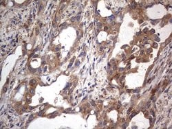 MTDH Monoclonal Antibody (OTI2F11), TrueMAB , OriGene 100 &mu;L; Unconjugated:Antibodies,