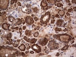 MTDH Mouse anti-Human, Clone: OTI2F11, lyophilized, TrueMAB 100 &mu;g;