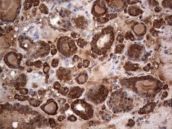 MTDH Monoclonal Antibody (OTI2F11), TrueMAB , OriGene 100 &mu;L; Unconjugated:Antibodies,