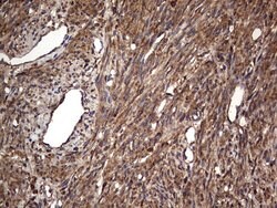 MTDH Mouse anti-Human, Clone: OTI2F11, lyophilized, TrueMAB 100 &mu;g;