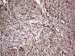 MTDH Mouse anti-Human, Clone: OTI2F11, lyophilized, TrueMAB 100 &mu;g;