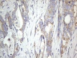 MTDH Mouse anti-Human, Clone: OTI2F11, lyophilized, TrueMAB 100 &mu;g;