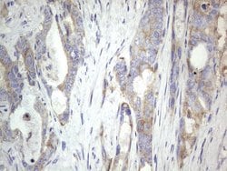 MTDH Monoclonal Antibody (OTI2F11), TrueMAB , OriGene 100 &mu;L; Unconjugated:Antibodies,