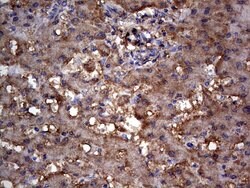 MTDH Mouse anti-Human, Clone: OTI2F11, lyophilized, TrueMAB 100 &mu;g;