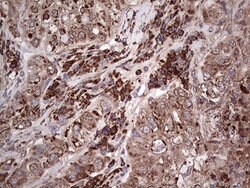 MTDH Mouse anti-Human, Clone: OTI1H1, lyophilized, TrueMAB 100 &mu;g; Unconjugated:Antibodies,