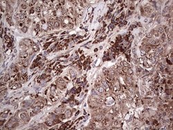 MTDH Monoclonal Antibody (OTI1H1), TrueMAB , OriGene 100 &mu;L; Unconjugated:Antibodies,