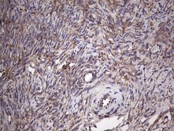 MTDH Monoclonal Antibody (OTI1H1), TrueMAB , OriGene 100 &mu;L; Unconjugated:Antibodies,