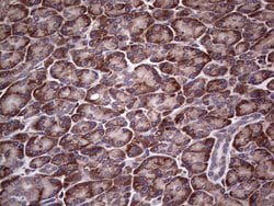 MTDH Monoclonal Antibody (OTI1H1), TrueMAB , OriGene 100 &mu;L; Unconjugated:Antibodies,