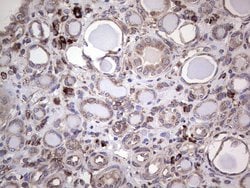 MTDH Monoclonal Antibody (OTI1H1), TrueMAB , OriGene 100 &mu;L; Unconjugated:Antibodies,