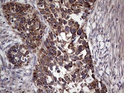 MTDH Monoclonal Antibody (OTI1H1), TrueMAB , OriGene 100 &mu;L; Unconjugated:Antibodies,
