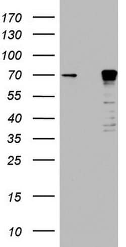 MTDH Monoclonal Antibody (OTI1E7), TrueMAB , OriGene 100 &mu;L; Unconjugated:Antibodies,