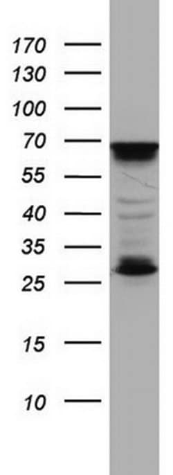 MTDH Monoclonal Antibody (OTI1E7), TrueMAB , OriGene 100 &mu;L; Unconjugated:Antibodies,