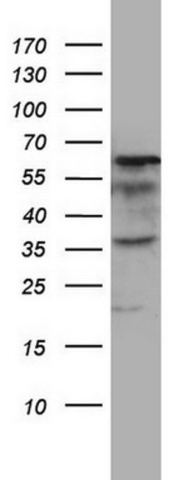 MTDH Mouse anti-Human, Clone: OTI2H4, lyophilized, TrueMAB 100 &mu;g; Unconjugated:Antibodies,