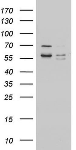 MTDH Monoclonal Antibody (OTI4C5), TrueMAB , OriGene 30 &mu;L; Unconjugated:Antibodies,