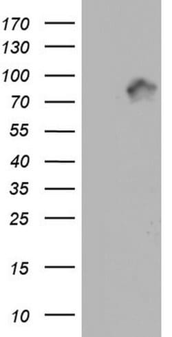 MTDH Monoclonal Antibody (OTI2A6), TrueMAB , OriGene:Antibodies:Primary