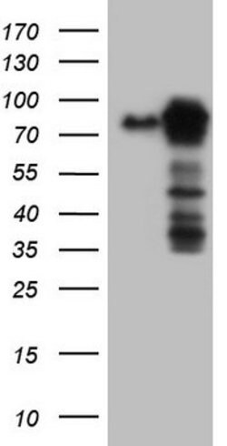MTDH Mouse anti-Human, Clone: OTI1H1, lyophilized, TrueMAB 100 &mu;g; Unconjugated:Antibodies,